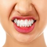 Tooth Filling: What You Should Know About It